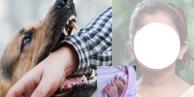 Stray Dog Bite Death